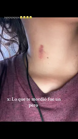 #viral_video #paratii #mordidadeperro😭☹️ #jajajajajajajajajajajajajaja #videoviral #videoviral 