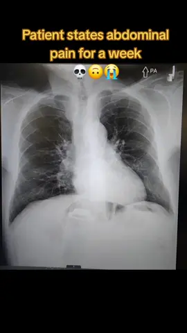 One word, how?! 😳 #xraytechnologist #radiologytechnologist #radiologylife #nurselife #nursesoftiktok #healthcareworker #healthcarehumor #icunurse #medsurgnurse #funnyxray  image credit: Reddit 