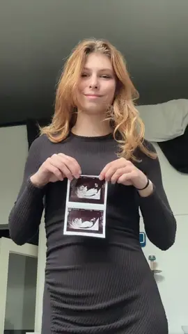 @Señior Pilo 🐱🇲🇽 🩷  #baby #pregnant #pregnancytiktok #pregnancyannouncement #mom #dad 