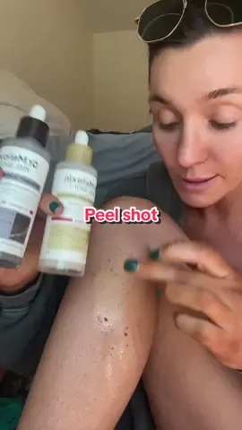 Replying to @giselle<3 STRAWBERRY LEGS ARE NO MORE #drmelaxin #koreanskincare #drmelaxinpeelshot #peelshot #peelshotampoule #skincare #strawberryskin #ttsbeautybesties #ttsdelightnow #Tiktokshopcreatorpicks  #tiktokshoprestock #dealsforyoudays #superbrandclub #summertransformation #summerwonderland #TikTokShopNewArrivals