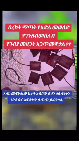 #creatorsearchinsights #በረከት ማጣት ?? #የእድል መወሰድ ?? #የገንዘብ መሰለብ ??   አጋጥሞዎታል ?? #እንግዲያውስ እያንዳንዱን  በዝርዝር እናያለን እስከ መፍትሔው የእድል መወሰድ ማለት ሰዎች እንዳለመታደል ሆኖ በጓደኞቻቸው በስራባልደረቦቻቸው በጓደኞቻቸው እድልና ሀብት በመቅናት በሀብታቸውና በጥሩ እድላቸው በማስጠንቆልና በማስመተት እድላቸውን ይወስዳሉ ሀብታቸውን ይሰልቧቸዋል ይህድርጊት ስልበት ወይም የእድል መውሰድ ይባላል። እድላቸው የተወሰደባቸው (የተሰለበባቸው ) ሰዎች እየሰሩ አያድጉም እየደከሙ አይሳካላቸውም በሄዱበት ስኬት የለም አግኝቶ ማጣት ለፍቶ መክሰር ደክሞ መቅረት  እየተመኝ አለመሳካት  ተወዳድሮ አለማሸነፍ ተናግሮ አለመሰማት  ጥያቄው ተቀባይነት ማጣት በጥቅሉ  ተመኝቶ  መቅረት ይሆናል ። #በረከት ማጣት በተንኮለኞች የተሰለበው ሰው ገንዘብ ቢይዝ አይበረክትም  የጀመረው ነገር አይዘልቅም ሲሰራውሎ ማታ ገንዘቡ አያድርም ብዙ ብር ይዞ ትንሽ ብር ሲያነሳ ሁሉም ብንብሎ ይጠፋል የአንዳንዶቹ ይባስ ብሎ ከተቀመጠበት ሳጥን ጠፍቶ ይቆያል እድገቱ እያደረ ቁልቁል ነው። ✅ከሳምንት ሳምንት ከወር ወር ከአመት አመት እድገቱ እያሽቆለቆለ ከአበዳሪነት ወደተበዳሪነት ይወርዳል ባስሲል አበዳሪም ይጠፋል ጓደኛ ባድ ዘመድ ሁሉ ይጠላዋል ፊት ያዘርበታል ድህነት ላይ ይወድቃል ። 👉በዚህም ምክኒያት ✅የእድሎች ሁሉ መዘጋጋት   ✅ተስፋ መቁረጥ  ✅መበሳጨት መናደድ ✅ማሰብ መጨነቅ ✅ተስፋ መቁረጥ የበታችነት ስሜት መሰማት ✅የፀባይ መቀያየር ድብርት ✅የእንቅል ማጣት ስሜት  ✅በሰመመን መጓዝ ✅የመርሳት ትውስታ ማጣት ✅የመሳሰሉት ችግሮች ይከሰታሉ ። ታዲያ እድሌነው ፈጣሪን ምንበድየው ነው ፈጣሪ እኔን አይወደኝም ከሰውበላይ እየለፋሁ ከሰው በታች ሆንኩ እያሉ ከማማረር ችግሮችን እንዴት ? በምን ምክንያት ? ከመቸ ጀምሮ ? ብለን መመርመርና መፍትሔውን መፈለግ የተሻለነው ። 🔁ለምሳሌ፦ አንዳንድ በሰይጣን አምላኪዎችና የሰይጣን ፈረሶች የሱ ግብር አደሮች እሄነን ስራ ይስሩ እንጅ  ጥበብ የተባለው ሁሉ ተመሳሳይ የክፋት መስሪያ አይደለም ዱባና ቅል አብሮ ቢበቅል አበላሉ እየቅል እንደተባለው የጥበብ ስራና ጥንቆላ በፍጹም አይገናኙም ሁሉንም አሽሞ ከጥቆላ ጋር ማያያዝ የተሳሳተ አመለካከት ነው። የጥበብ ስራና ጥቅም አገልግሎት ከባሕላዊ ሕክምና እስከ ዘመናዊዩ ሕክምና አገልግሎት እየሰጠና የዓለም ሕዝብ እየተጠቀመበት ያለው ጥበብ  የተገኘው ከታላቁ ሊቅና በእግዚአብሔር ከተመረጠው ታላቁ ሰው ሄኖክ ነው የጥንቆላና የክፋትን ስራ ያስተማሩት ደግሞ ከሰማይ ወደመሬት የወደቁ መላኢክቶች ወይም የአዛዝኤል ነገዶች በሴቶች ውበት በመማለል ከሴቶችጋር በመዳቀል ለወለዷቸው ልጆች ጥንቆላ  ሟአርት  መተት  የተለያዩ የክፋት ስራዎችን  እንዳስተማሯቸው ታሪክ ያስረዳናል። ነገር ግን ክፉውን ትተን መልካሙን  ክፋትን ትተን መልካምነትን እናስብ እናስተምር ሁሉንም በክፉ አንፈርጅ መልካም መልካሙን እንጠቀመው። 👇👇👇👇👇👇👇👇👇👇👇👇 #በዝህ ችግር ለሚሰቃዩ ወገኖቻችን ይደርስ ዘንድ #share/ፔጃችንን/Like ማድረግዎን እንዳይረሱ  ከዚህ በተጨማሪ የምሰጣቸው #የሕክምና አግልግሎት 👇👇👇 1🌿 ለኪንታሮት 2🌿 ለሆድ ዉስጥ ስራይ 3🌿ለኢሪህ 4🌿 ለጨጓራ  5🌿 ለተለያዩ ስረዮች መፍተሔ 👇 ☎️ 📞 0900639280 ይደውሉ  ሐሳብ አስተያየት ካላችሁ ፃፉልኝ ☑ አድራሻችን /ማንኩሽ ከተማ/ ፀሃይ ሆቴል በስተጀርባ ወደ ዉሰጥ ገባ ብሎ  እፅዋቶችን ከታች ይመልከቱ 👇👇👇👇👇👇፦fyp 