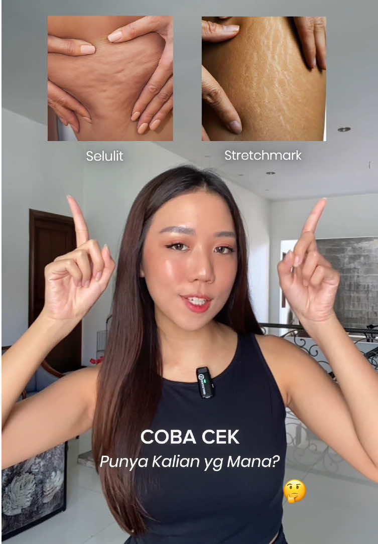 Kadang, dua”nya jg bisa muncul di area yg sama. Both are not something to be ashamed of and are very normal, but ga ada salahnya buat lbh dirawat; just as we take care of our faces 🥰 Anyways, klo pny kalian yg mana? #stretchmarks #stretchmark #stretchmarkserum #stretchmarkoil #ciaraindonesia