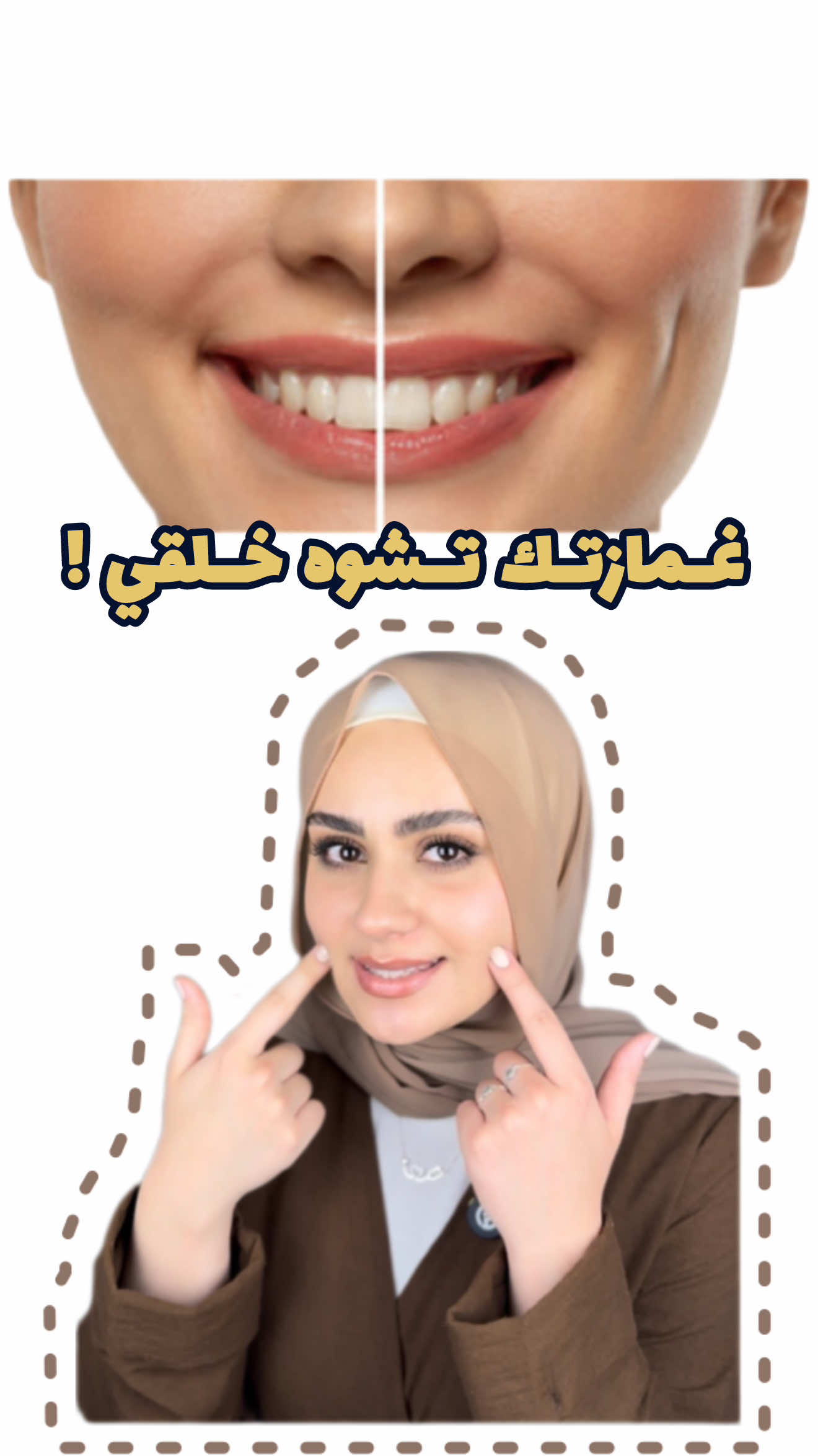 مين صنّف الغمازة ك علامة جمال ؟! 🤔  #سجى_شدوح #مش_غلط #fyp #غمازة #غمازات #عملية_غمازات 