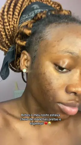 #carygomes #fyp #viral #viralvideos #guinebissau #guiguis🇬🇼 #guinebissautiktok🇬🇼🇬🇼🔥 #palops🇦🇴🇲🇿🇸🇹🇨🇻🇬🇼🇧🇷🇵🇹 #palops🇦🇴🇲🇿🇸🇹🇨🇻🇬🇼 #guinebissautiktok🇬🇼 #foryou #palops🇦🇴🇲🇿🇸🇹❤️💍 #UK  #portugal🇵🇹 