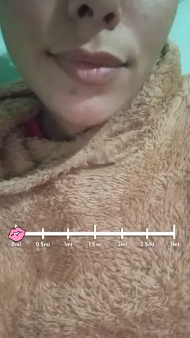 si tuviera boxto en los labios me quedo con mis naturales 