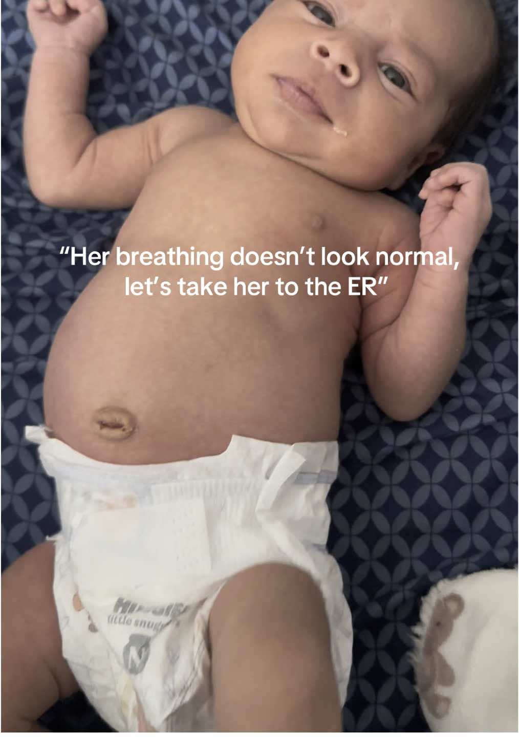 Link in bio to read about my daughter’s story. ❤️‍🩹 A nightmare no parent or baby deserves to experience. Thank God she’s doing okay now, F* Cancer.  #LeiahStrong #Childhoodcancerawareness #Neuroblastoma #NeuroblastomaWarrior 