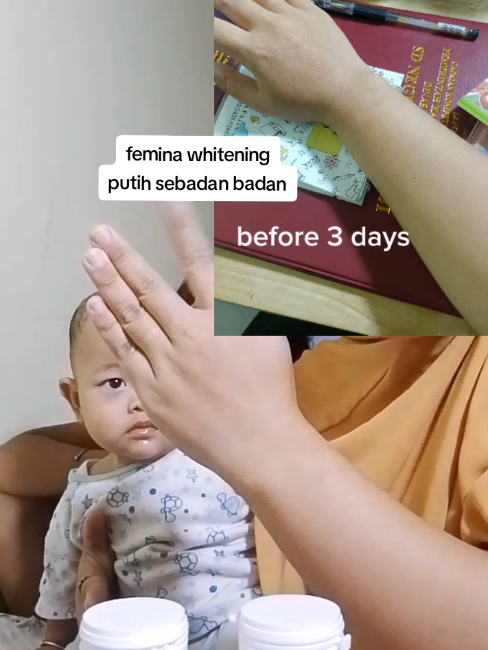 Baru 3 hari coba Femina Suplemen Whitening... dan klaimnya bisa mencerahkan dalam 5 hari?! 😳 Kita buktiin bareng-bareng yaa~ ✨ Kulit lebih cerah dari dalam ✨ Nggak bikin perih atau mual ✨ Klaimnya 5 hari ada hasil, aku udah 3 hari nih! #FeminaWhitening #SuplemenPemutih #ReviewJujur #KulitCerahAlami #WhiteningSupplement #CerahDariDalam #SkincareFromWithin #FeminaChallenge #HariKe3 #whiteningjourney 
