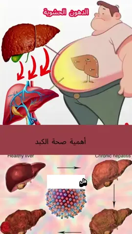 ‎شاي الكبد يغذي الكبد وينشطه#liverdisease #صحيح #healthytips #الكبد_الدهني #liver #الكبد #fattyliver #liverhealth #healthydrink #liverdetox #fatty 