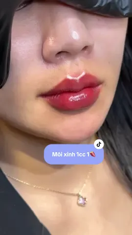 Môi xinh cam thường 1cc 1🍠 B.si 8 năm kinh nghiệm thực hiện  Tất cả đều là hàng chính hãng cty Check qrcode test tan Ti.em đẹp mới phải thanh toán ❤️ #filler #moibaby #filleruytinhanoi #moibabylips #lamdep #Donabeauty  #xuhuong 
