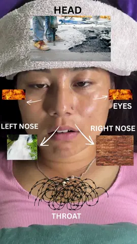 When you are Sick 😷 Read Captions Below: Headache - Rest in quiet, dark room. Hot and cold compress to your head and neck. Do some breathing exercises. Hydrate yourself. Burning Eyes- Cold compress and proper eyelid hygiene and apply lubricating eye drops to improve eye comfort. Blocked Nose - Drunk plenty of fluids, take a humidifier, warm shower, take steam, use saline nasal spray. Sore throat- Gargle with warm salt water, stay hydrated, drink warm beverages like tea with honey, use humidifier. #fypシ #foryou #trending #relatable #health #funnyvideos #instagood #tiktok #viral #viralvideo @Sky Will @RohaniLamaisrich @Health 