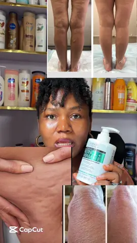 Lotion for wrinkled skin #advancedclinicalsretinol #wrinkledskin #retinolskincare #retinol #glowingskin #skincare #SkinCare101 #brighteningtoner #brighteningskincare #skincaretips #glowingskin #skincarevendorinmakurdi #nigeriansinuk🇳🇬🇬🇧 #nigeriansinuk 