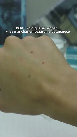 Las manchas oscuras y pecas no deberían existir  #fypシ #fyp #skincare #dealsforyoudays #darkspots #foryoupage 