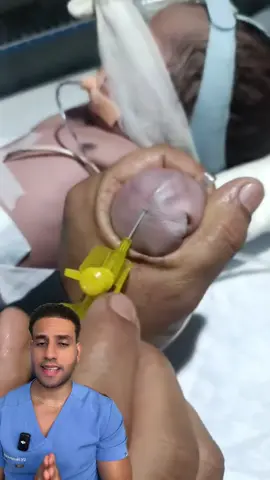 Así se canaliza un recién nacido👶🏻 #doctor #pediatria #medicina 