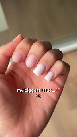 LlNK lN BlO❤️‍🩹 #stress #nailbiting 