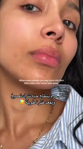 ✨روتين د. جفري بسيط وفعال لعلاج الحبوب مع تصبغات✨ ‼️ أثنين في واحد ‼️ ✅ ٣ خطوات الصبح و ٣ خطوات الليل ✅ النتيجة مضمونة 💯  ☀️الصباح ☀️  1. الغسول: بانوكسيل كويس! نبتعد عن الغسولات الي فيها ساليساليك ومقشرات الصبح (حتى لو مكتوب عليه استعملي صبح وليل) وحتى لو صحيتي وجهك مزيت! غسول خفيف او ماء فقط 2. بعد تنشيف الوجه بنحط نايسنامايد (في فيديوهات في الصفحة على الانواع الممتازة) 3. واقي شمس خفيف! ما يكون في دهون عشان ما يقفل المسام ويعمل حبوب - في فيديو عليهم  🌙المساء 🌙 1. الغسول مهم أول ما نرجع من بره! ويفضل يكون في ساليساليسك وجلايكولك (في انواع كثير! مثلاً سيرافي بليمش كونترول أو بايوديرما الاخضر) 2. مرطب خفيف - البشرة الي بيها حبوب إذا نشفناها جداً من الدهن تفرز دهن اكثر كردة فعل عكسي! في فيديو في الصفحة عن المرطبات المائية! التوازن مهم ‼️  3. ليله مشتقات أ - ريتينول / اكرتين (لو حامل نستعمل ساليساليك تونر أو جلايكولك على بشرة جافه تماماً مثل باولاتشويس أو كريم في ساليساليك ٢٪؜) 4.  وليله ازيليك مثل سكنورين او الي حطيته في الفيديو  بيعالج الحبوب والتصبغ بس الازيليك ياخذ وقت عشان يشتغل!  #ab#abdulhadi_jfrif#jfri_dermatologistf#jfri_skinr#drjfriب#عبدالهادي_جفريك#دكتور_جفريك#دكتور_جفري_جلديةك#دكتور_جفري_جلديةوتجميلك#دكتور_جفري_تجميلف#جفري_بشرةف#جفري_نضارةك#دكتور_جفري_تفتيحو#روتين_جفري#رو#روتين_عنايةو#روتين_العناية_بالبشرةو#روتين_يوميk#skincarek#skincaretipsk#skincareproductsk#skincareroutinek#skincarenaturalك#اكسبلور_فولول#السعوديةد#جدةل#الرياضل#الكويتب#دبيx#explore‎ #ال#الشعب_الصيني_ماله_حل😂😂ر#ترندل#الترندr#trendr#trendingy#fypy#fyppy#fypppppppppppppppppppppppy#fyppppppppppppppy#fyppageforyou ‏#li#lipsi#lipsfillers💋ي#فيلري#فيلر_شفايفb#abdulhadi_jfrif#jfri_dermatologistf#jfri_skinr#drjfri#عب#عبدالهادي_جفريك#دكتور_جفريك#دكتور_جفري_جلديةك#دكتور_جفري_جلديةوتجميلك#دكتور_جفري_تجميلف#جفري_بشرةف#جفري_نضارةك#دكتور_جفري_تفتيحو#روتين_جفري‎#اك#اكسبلور_فولول#السعوديةد#جدةل#الرياضل#الكويتب#دبيx#exploreساقط_الشعر