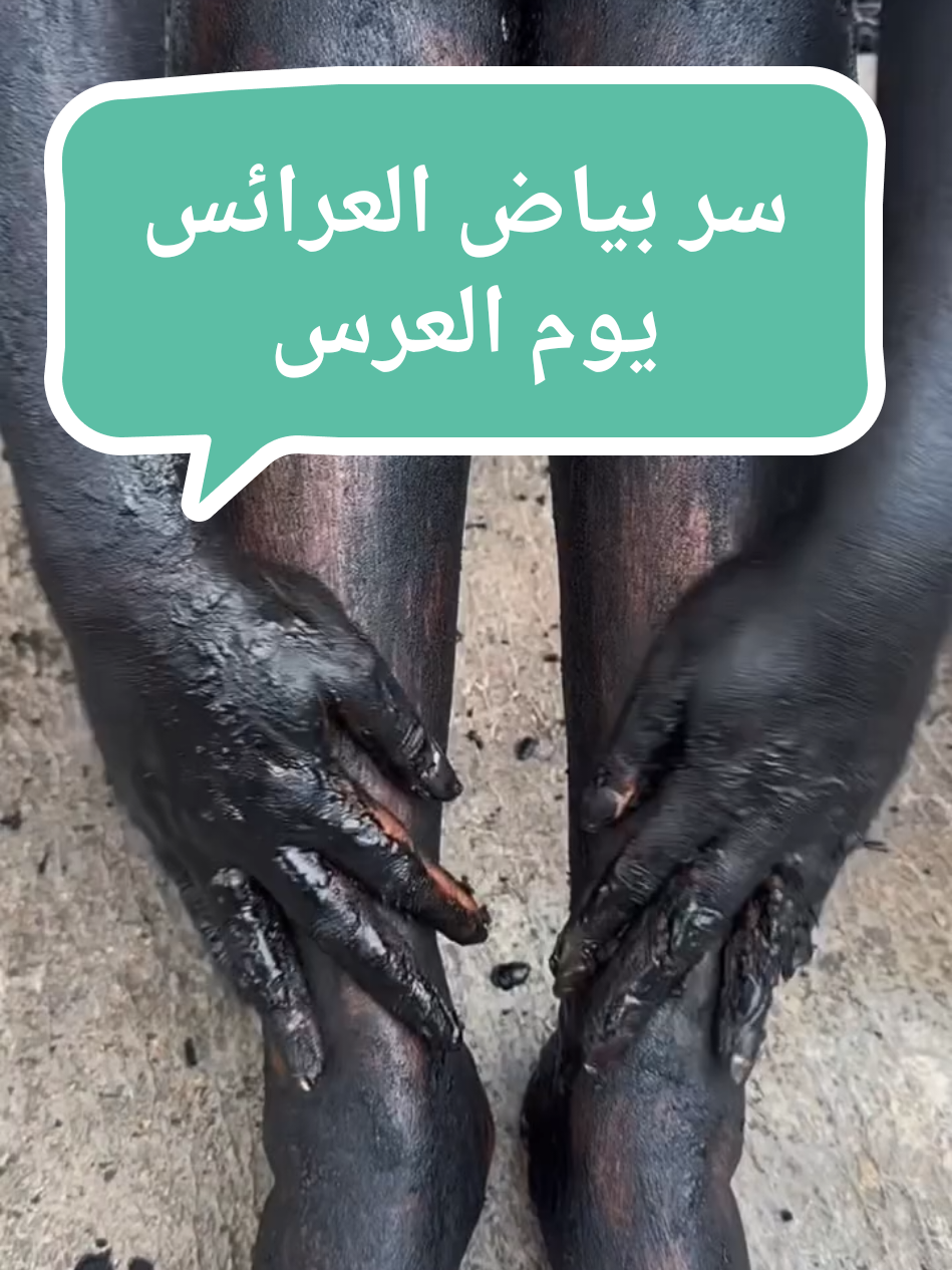 سر بياض العرائش يوم العرس✨💯 #explore #foryou #fyp #pourtoi #اكسبلور #bride #brightingskin #maskbright 