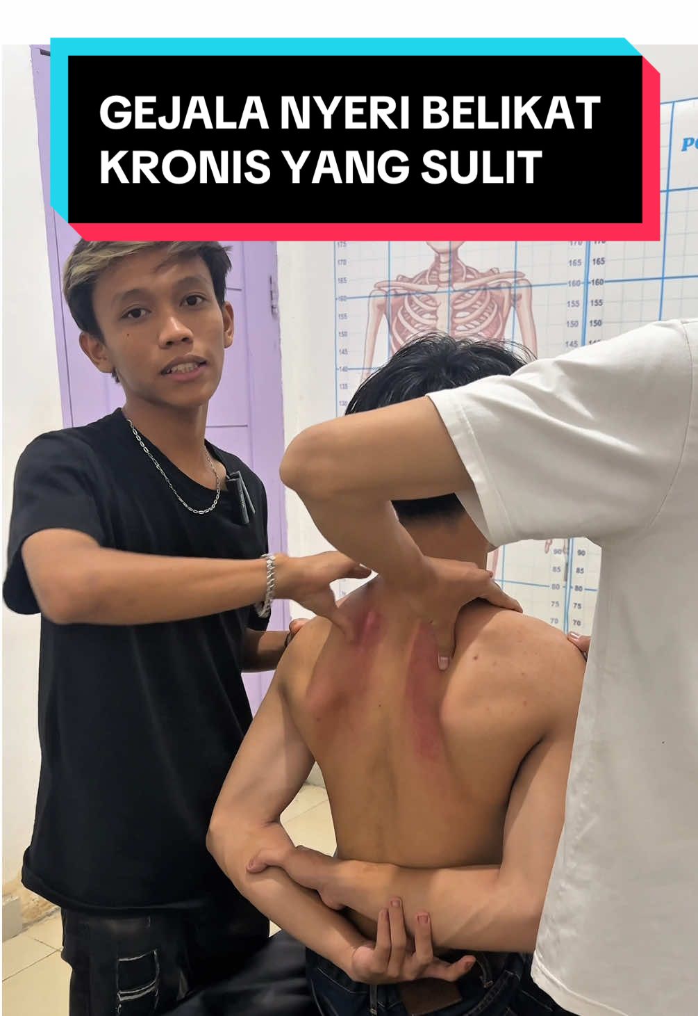 APAKAH KALIAN JUGA MERASAKAN NYERI DI BELIKAT ? YUK SEMBUH ! . Kami Buka Setiap Hari. Kecuali Minggu. Wajib Boking Dulu. Pelayanan 09:00-17:00.  Alamat kami di Pontianak. Kota Baru Ujung. Jl. Karya Gg. Alistiqomah No. 18B. Jalan luas bisa masuk dan parikir mobil 2.  Biaya terapi mulai dari 150-500rb.  Untuk info lebih lengkapnya hubungi 08981691551 #kretekpontianak 