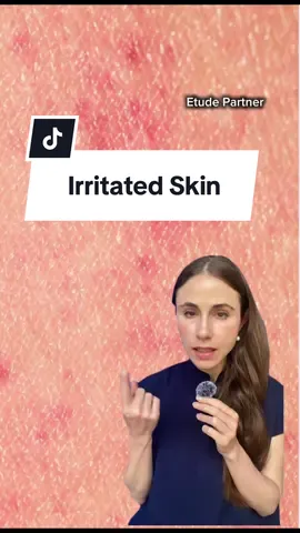 #EtudePartner When skin is irritated and sensitive, you need a moisturizing cream designed to soothe sensitive skin and strengthen the skin barrier @etudeofficial SoonJung 2X barrier intensive cream is a no brainer here, because it is a  fragrance free, low-irritant ,and a weakly acidic formula with panthenol to reinforce the skin barrier and retain moisture, along with madecassoide to calm and protect irritated skin. Best of all, it is on BIG SALE right now for Amazon Prime Day, so check the link in my bio to grab yours today!