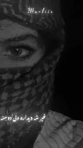 #tiktok_viral_video #tiktok_foryou_trick #2millionviews✨🎧  #fypシ゚viral🖤tiktok  #اومد_حتما_مارو_دنبال_کنید👇💯 