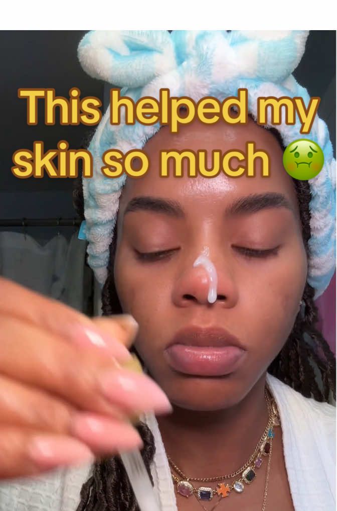 Replying to @Naturally Beautifull hope this helps, if it does I’ll do more videos #deadskin #sebum #oilyskin #cloggedpores #rice #skincarehacks #drmelaxin #peelshot 