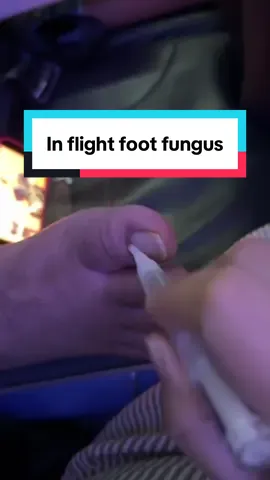 Some dude on my flight had his bare, fungus-covered feet right next to me… I almost moved seats. If your toes look like THAT—do us all a favor and get the Lunavia pen. It’s not that hard. Swipe it on and let it work. Airplanes are tight. Your fungal situation shouldn’t be. #tiktokshopcreatorpicks #tiktokshopcreatorfinds #ttslevelup #tiktokshoplifestyle #tiktokshopsummerturnup #dealsforyoudays #summervibes #publicfeetproblems #nailfungusfix #airplanepetpeeve Lunavia nail pen toenail fungus fix nail fungus treatment fungus feet travel horror story clear nails fast toenail nightmare nail care for men TikTok shop find fix your feet bro