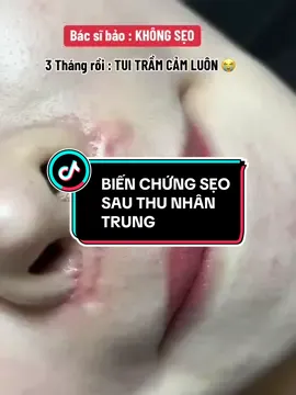 🌏 THU NHÂN TRUNG có thật sự không sẹo như quảng cáo không 😭 #xoaseonhantrung #thunhantrung #XuanNguyen_ColdPlasma #DaotaoSpaChuyenNghiep #coldplasma #langletaisinh #triseosauphauthuat #SimpleBeauty 