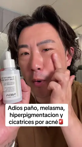 Dile adiós a manchas, paño y cicatrices con este toner nuevo!!😊 #titkokshopcreatorpicks #kbeauty #skincare #fyp 