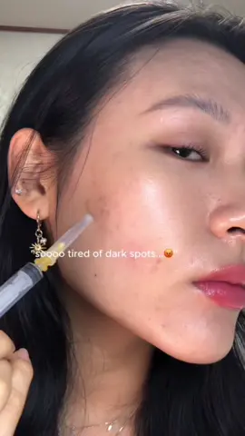 Korean’s dark spot treatment with @ISOI @ISOI Global - they’re having a 50% off during Amazon Prime Deals🛍️ Go check! :) #darkspot #darkspotserum #darkspotstreatment #kbeauty #koreanskincare #serum #blemishes #postacnemarks #amazonfinds #amazonprimeday #amazonprimeday2025 #creatorsearchinsights 
