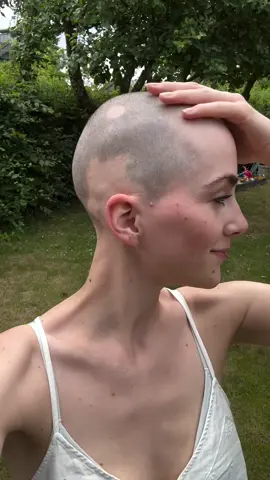 ‼️ Wait for it 😁 I did it. They’re gone. I’m rid of them 🥲😮‍💨🙏🏻👩🏻‍🦲 ••• Hi 👋🏻 my name is Eileen 🧚🏼 and I have alopecia areata. If you’re also affected, be sure to follow me. Because shared pain is half the pain ❤️‍🩹 ••• And sure... There’s some sadness, but the relief outweighs it! AND: Guys, as strange as it sounds, I didn’t feel like a stranger at all when I first looked in the mirror 😅🤌🏻 it’s a bit like homecoming - crazy, right?! P.S.: How sweet is it that @jaroniak1909 also shaved his head in solidarity? 👨🏻‍🦲🥹❤️‍🩹 CIRCULAR HAIR LOSS | BALD | ALOPECIA AREATA #circularhairloss #alopecia #alopeciaareata #alopeziagermany #alopecia #hairloss #hairlossinwomen #alopeciaawareness #MentalHealth #mentalhealthmatters  #rockthatbuzz #girlswithshavedheads #baldisbeautiful 