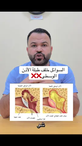 اذا لاحظت وجود تاخر بالكلام عند أبنك او انزعاج من الأصوات العالية استشير الطبيب #توعية_اجتماعية #تعلم_على_التيك_توك #تطور_الطفل