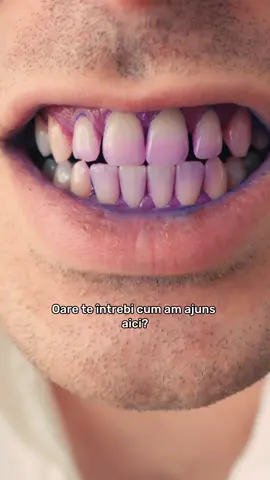 Ad//Aveți grijă de dantura voastră... Eu am trecut pe Philips Sonicare Prestige 9900 și nu mai există cale de întoarcere. Uită-te la clip și o să înțelegi de ce. Codul ERIC25 îți oferă 25% reducere pe philips.ro, până la finalul lunii august. Reducerea se cumulează cu promoțiile deja existente de pe site (dar nu și cu alte coduri)! @PhilipsRomania  #nevergoingback #FeelTheCare #PhilipsSonicare 
