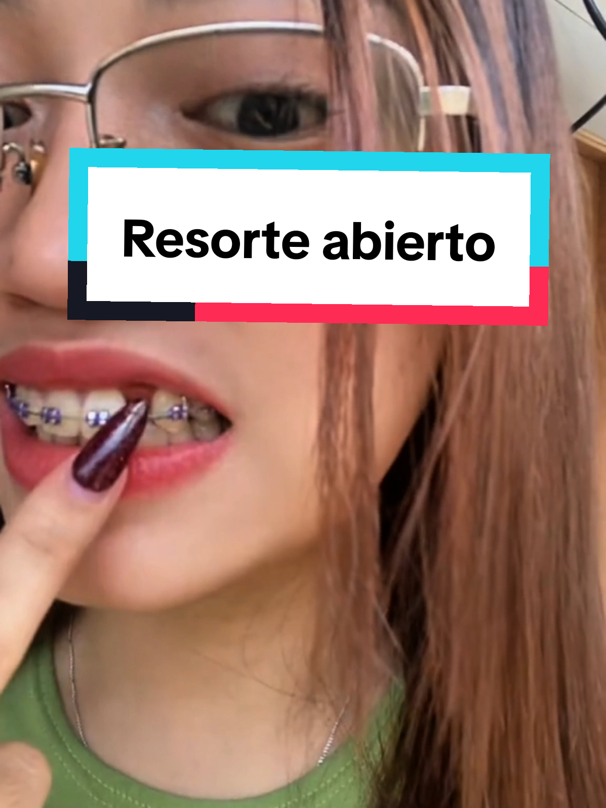 Resorte abierto #ortodoncista #bracketsmetalicos #ortodoncistaentiktok #chiclayoperu🇵🇪❤ #dentista