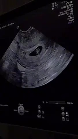 هلا بجيتك يروح الروح 👼🏻🙈💙🩷 . . . . . . #الشعب_الصيني_ماله_حل😂😂  . #حوامل_اي_شهر_صرتو_🤰🤰😍🦋  #ثمرة_حبنا_الاولى🥺 