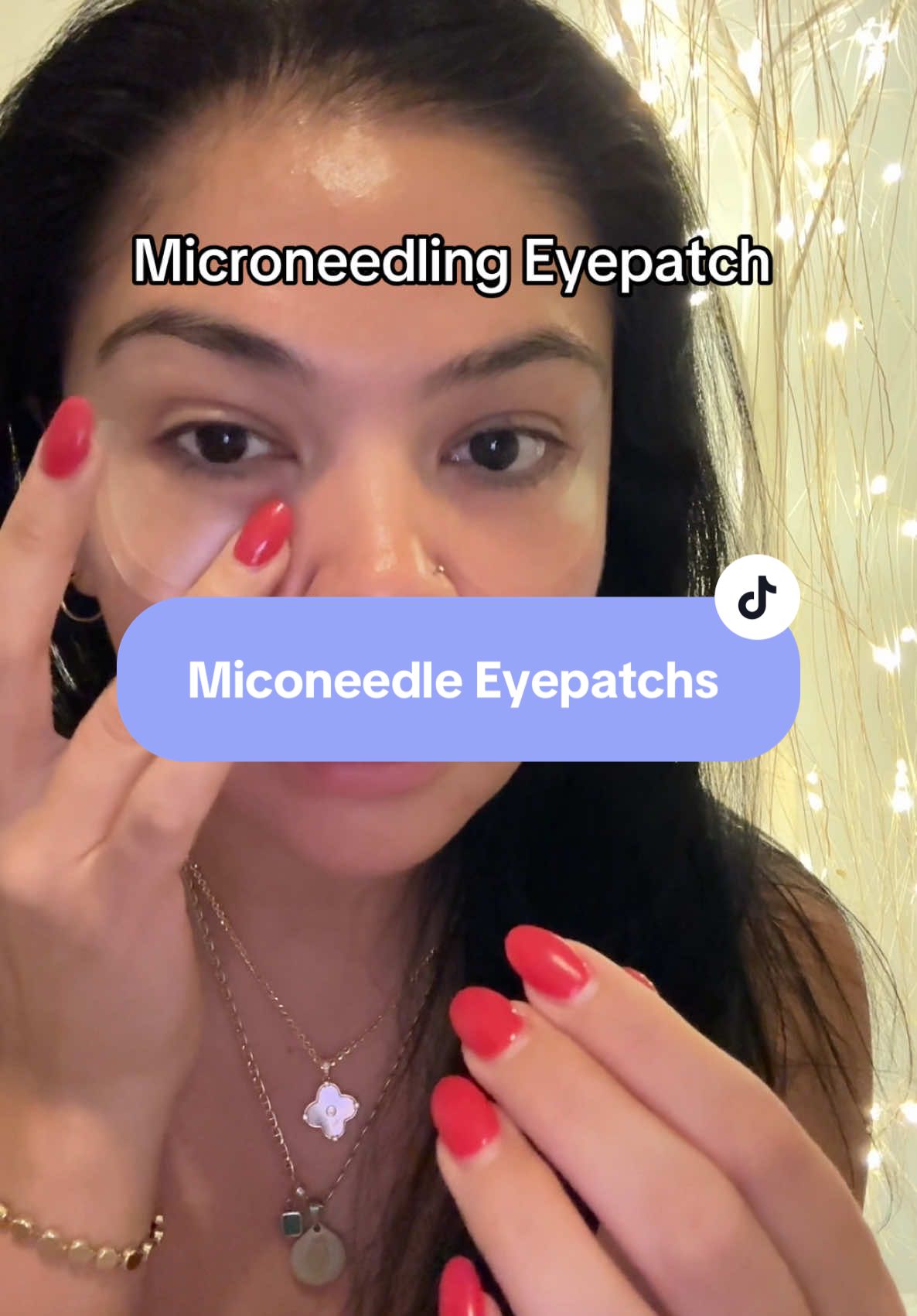 #creatorsearchinsights #smallcontentcreator #microneedling #eyepatches. 🌟 What It Is A professional-grade microneedle eye patch featuring 1,254 self-dissolving micro‑needles infused with 50 mg of 4‑D Hyaluronic Acid. These tiny needles create “invisible” micro-channels under the eye, boosting absorption of hydrating and anti-aging actives   