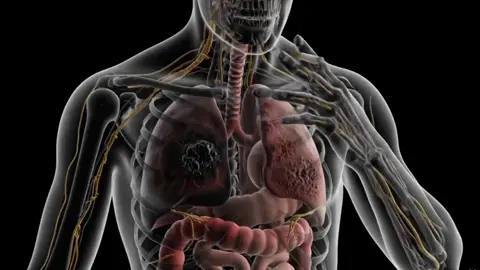 O que o cigarro faz com o seu corpo por dentro #Saúde #PararDeFumar #CorpoHumano #Pulmões #CigarroMata