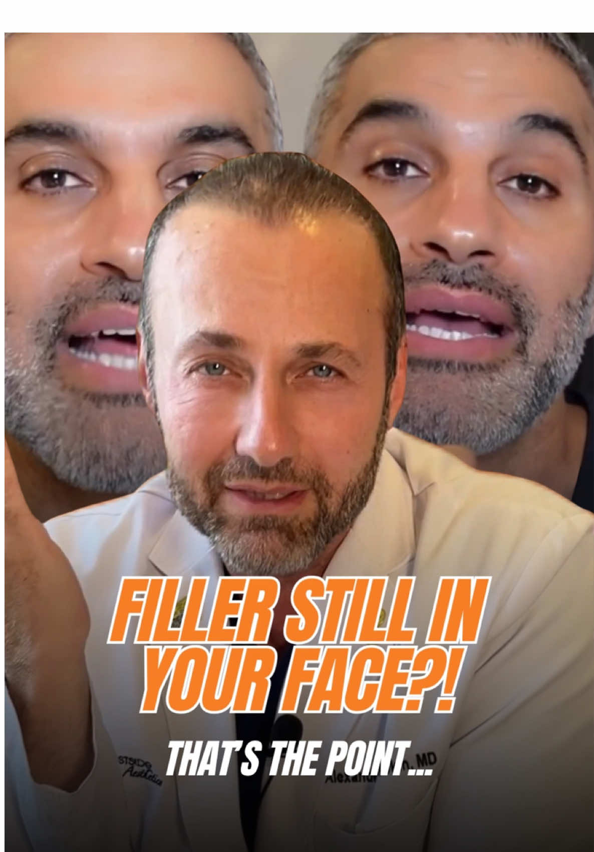 Apparently, filler lasting more than a year is now a problem? 🤔 A recent video’s been making the rounds, warning people that hyaluronic acid filler can hang around for longer than we originally thought — and making it sound like that’s a bad thing. But let’s think about it: if your filler still looks good and isn’t causing any issues… where’s the problem? Longevity is a perk, not a complication.  The video also implies that having filler in the face makes surgery harder or causes inflammation and scar tissue. That’s just not true. He’s worked on plenty of surgical patients with filler — it’s very straightforward. You scoop it out if needed and move on. The anatomy is still in perfect working order. Hyaluronic acid doesn’t trigger inflammation or fibrosis. That’s not speculation — that’s backed by years of solid data and real-world experience. Let’s not scare people over filler doing what it’s supposed to do. Yes, every face is different, and yes, more research is always helpful. But this kind of fear-based messaging doesn’t help anyone. If filler ever becomes an issue, we dissolve it. Simple as that. 💉 #filler #hafillers #injectables #injectorsoftiktok #expertinjector #plasticsurgery #rivkinaesthetics #drrivkin 