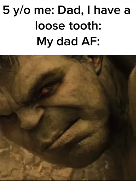I definitely snitched on him to my mother #Meme #MemeCut #edit #CapCut #marvel #marvelstudios #marvelcharacters #ironman #hulk #avengersageofultron #avengers2 #ironmanvshulk #hulkbuster #loosetooth #goingdown? #imsorry #funny 