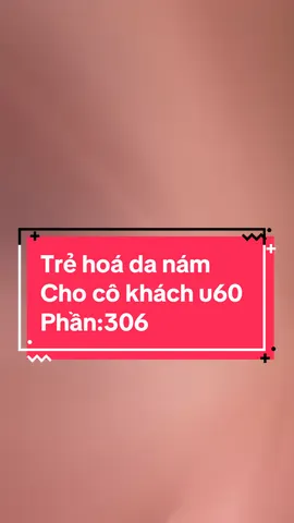Đủ woaaa chưa ạ !!! Trẻ hoá làn da lão hóa :đồi mồi,nám,tàn nhang,da chảy sệ nhiều nếp nhăn cho cô khách u60 !!! #điều_trị_nám #oanh_chuyên_nám #chuyên_giải_quyết_các_vấn_đề_về_da #oanh_chuyên_trị_nám #nám #tăng_sắc_tố_da #peel_nám #oanh_trị_nám #laser_Co2_trị_Nám #trị_nám_tàn_nhang  