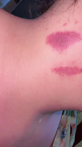 #foryou 