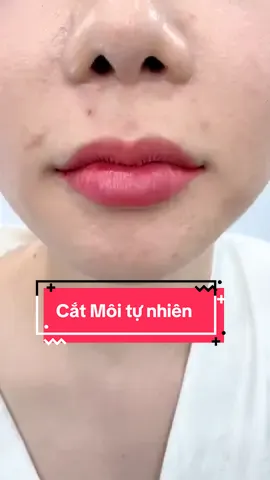 Cắt môi baby tự nhiên #cắtmôitimtựnhiên #cắtmoitraitim #cắtminideep #nhấnmiplasma #cắt_minideep 