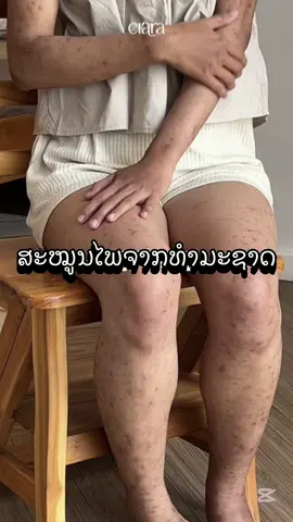 #ขาย #ฟิดดดดดดดดดดด🥺 #ขาลายน้ําเหลืองเสียต้องโดนตัวนี้ 