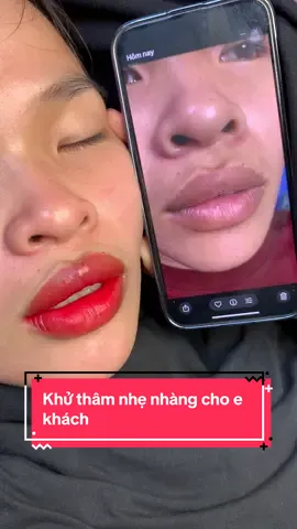 Khách hành thích khử thâm lên màu nhẹ