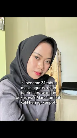 Jian sibuk nemen sampe lupa target nambah anak #acneskin #acnefighter #fyp
