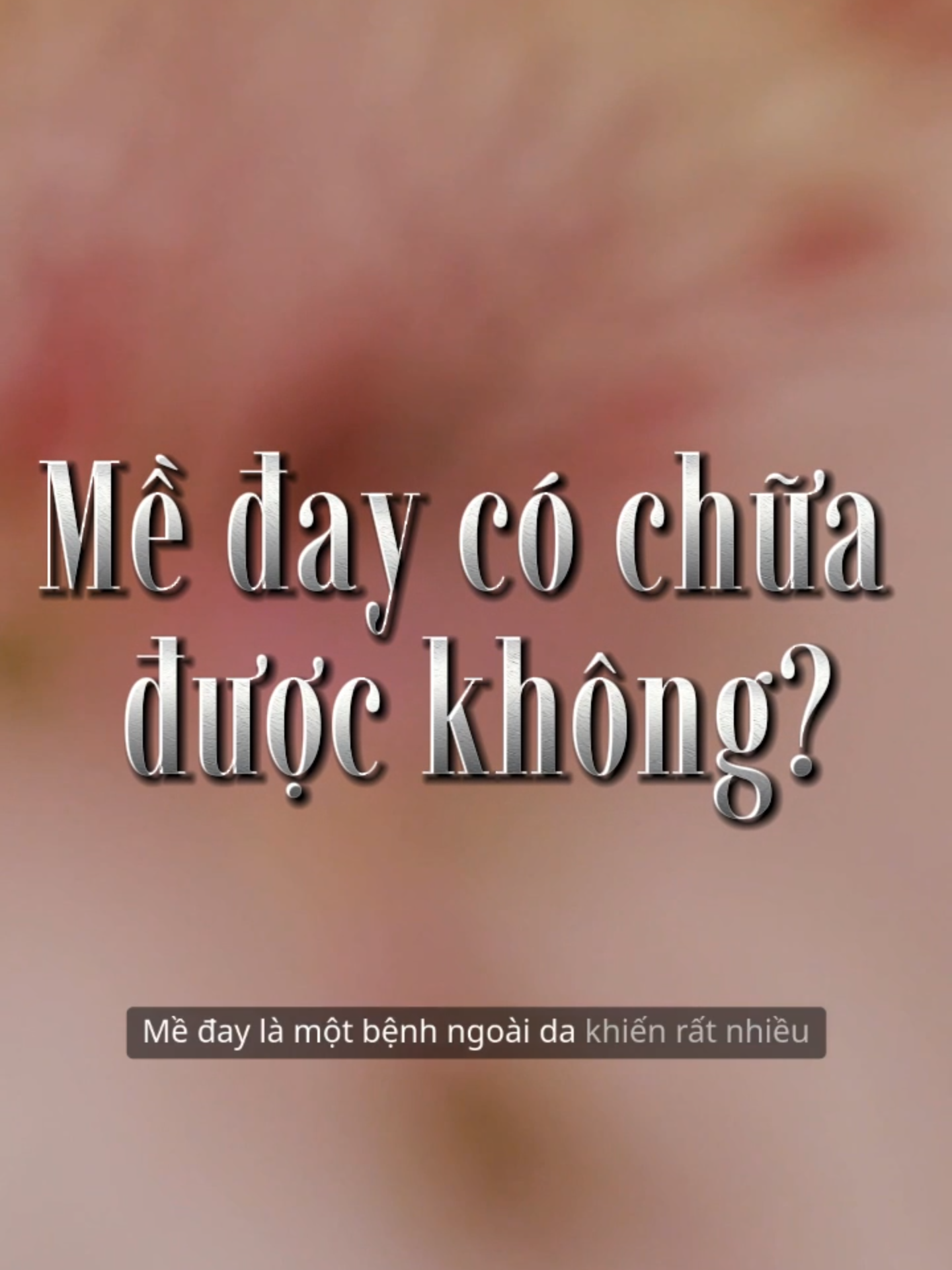 Mề đay có chữa khỏi được không? #phubikhang #meday #diung #manngua #diungthoitiet #giamngua