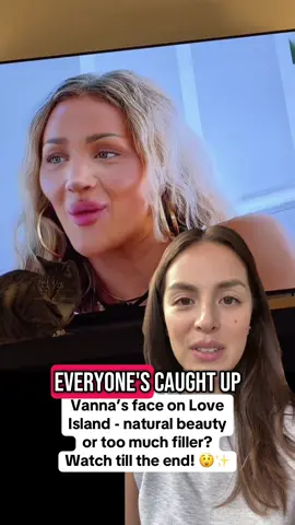 Why does Vanna’s face look so different from everyone else on Love Island? 😳 #antiaging #skincare #LoveIsland #loveislandusa #vannaloveisland #beautywithoutbotox #naturalbeauty #usa #glowingskin 