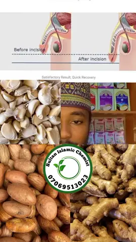 #sultan_islamic_medicine #crreatorsearchinsight #garlicrecipe #garlic 