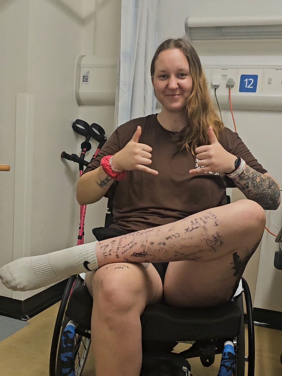 Welp #amputation #amputee #goodnews #huzzah 