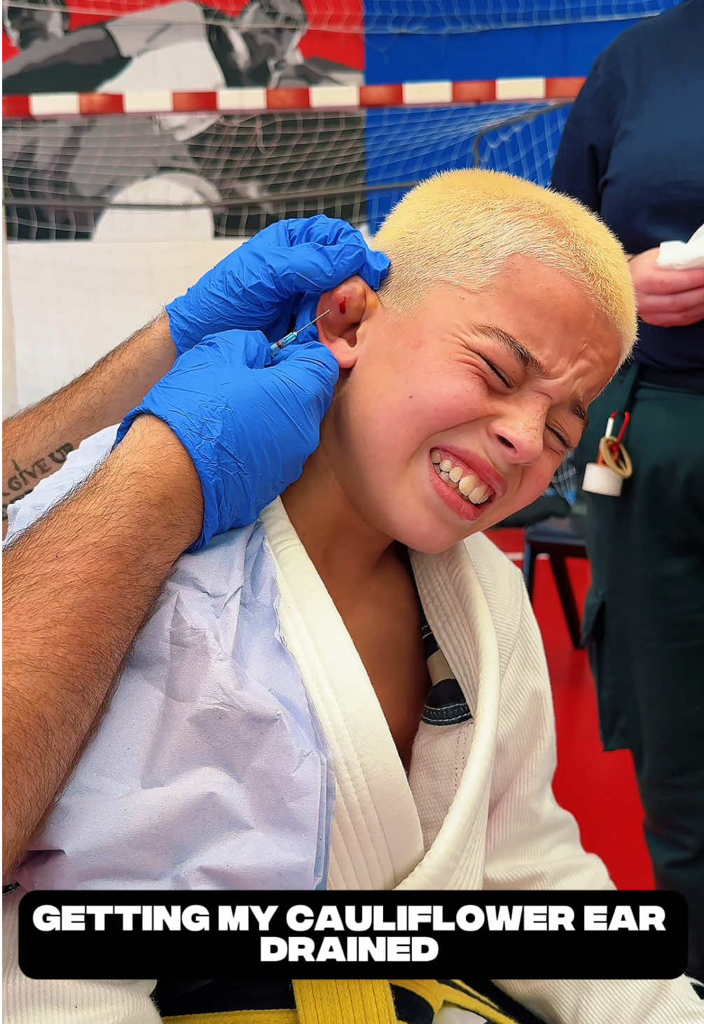 Getting my cauliflower ear drained #bjj #bjjlife #kidsbjj #cauliflowerear 