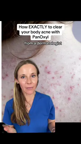Don’t sweat body acne How to use PanOxyl for body acne from a Dermatologist  ✅ Wet skin in shower ✅ Lather dime-size Acne Foaming Wash 10% benzoyl peroxide on affected areas ✅ Let sit 2 min — kills acne bacteria ✅ Rinse well (avoid bleach stains!) ✅ Pat dry (white towel) ✅ Spray PanOxyl Acne Banishing Body Spray (clear acne and brightens skin) ✅ Moisturize + SPF Shop PanOxyl at any major retailer or via the link in my bio #panoxylpartner #PanOxyl #ClearSkin #dermtips #bodyacne #acne  