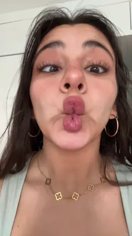 #crosseyed #fishyface #fishlips #sillygirl #luckylacyrose #newaccount #lips #silly 